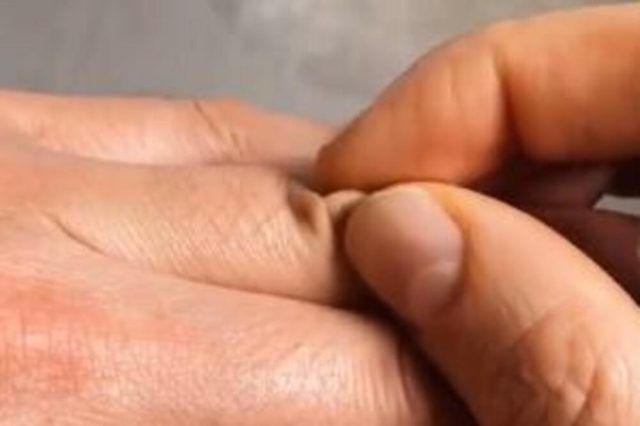 1177873 prsti ls 1177873 prsti ls