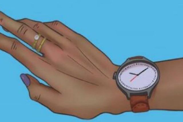 1515476 mozgalica ls