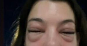 1525655 bez naziva ls