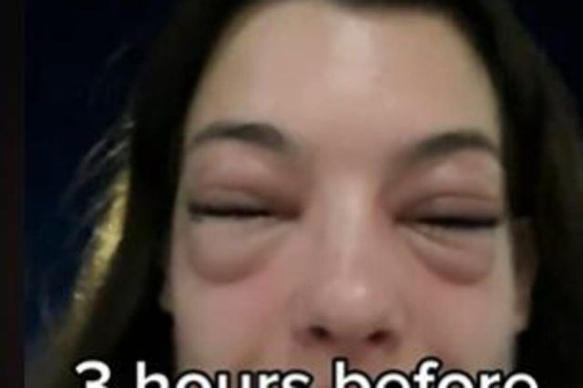 1525655 bez naziva ls