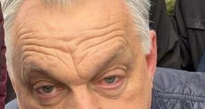 orban.v1 830x10241